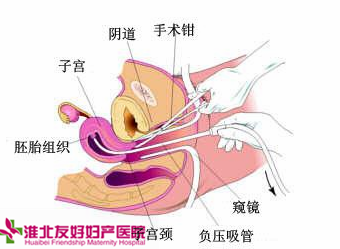 什么原因导致女性免疫性不孕