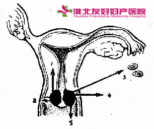 如何检查宫颈癌的发生呢?